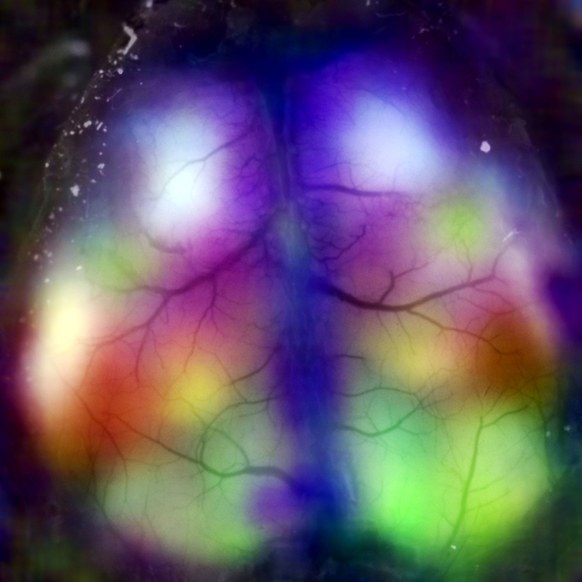 Watch a Resting Brain Light Up With Activity