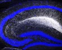 Tangled Up and Blue: Neurons’ Faulty Wiring Leads to Serotonin Imbalance, Depression-Like Behavior in Mice