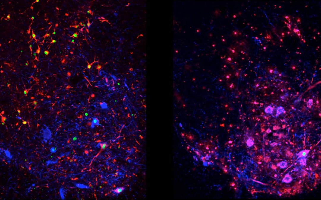 Study in Mice Reveals that Body’s Own Defense Against ALS Actually Drives Disease Progression at Later Stages