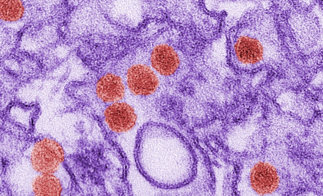 For Zika Virus, Infecting Brains Isn’t A New Trick