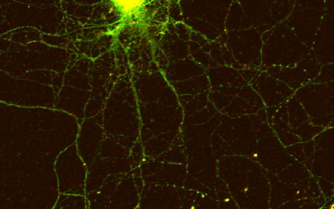 Pinpointing How Cells Regulate Long-lasting Memories